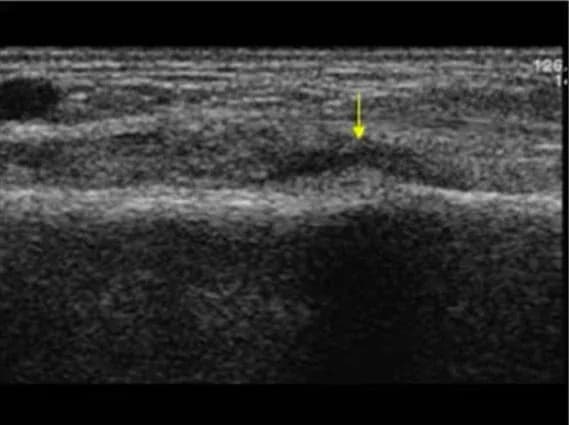 Sonografie2