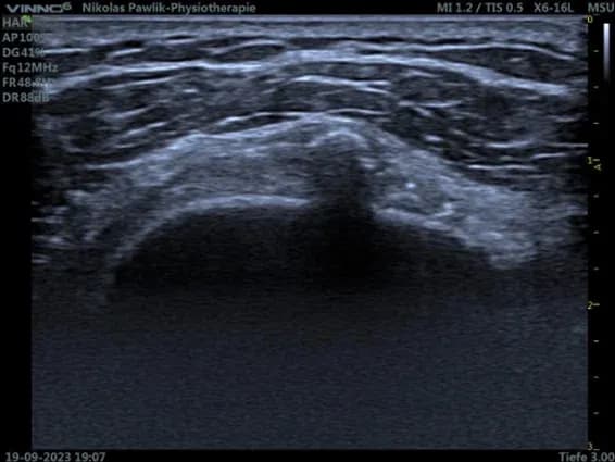 Sonografie3