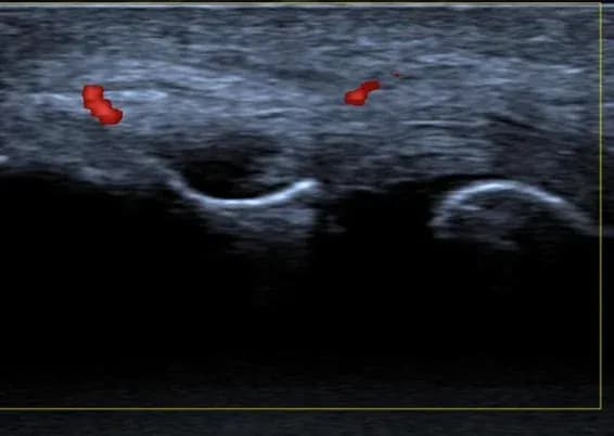 Sonografie4