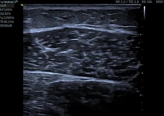 Sonografie5