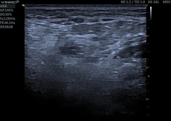 Sonografie6