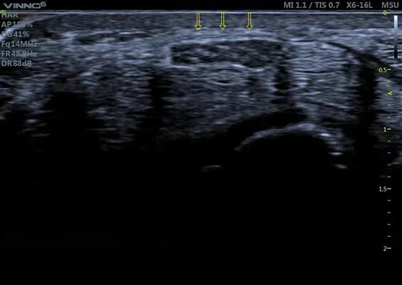 Sonografie7